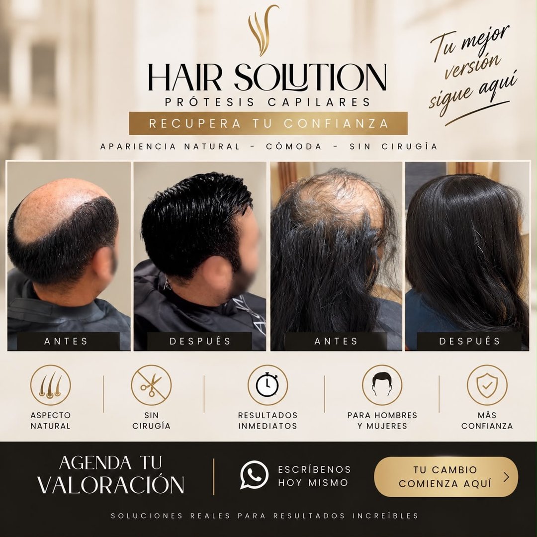 Anuncio de Hair Solution: prótesis capilares