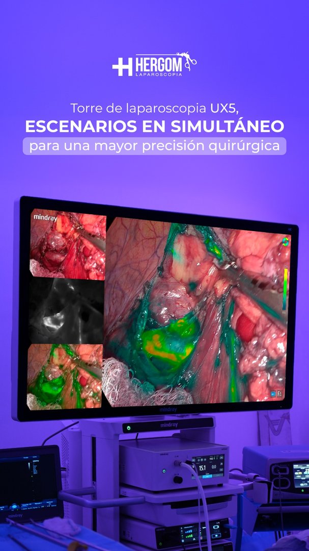 Anuncio de Hergom Medical: Torre de laparoscopia UX5