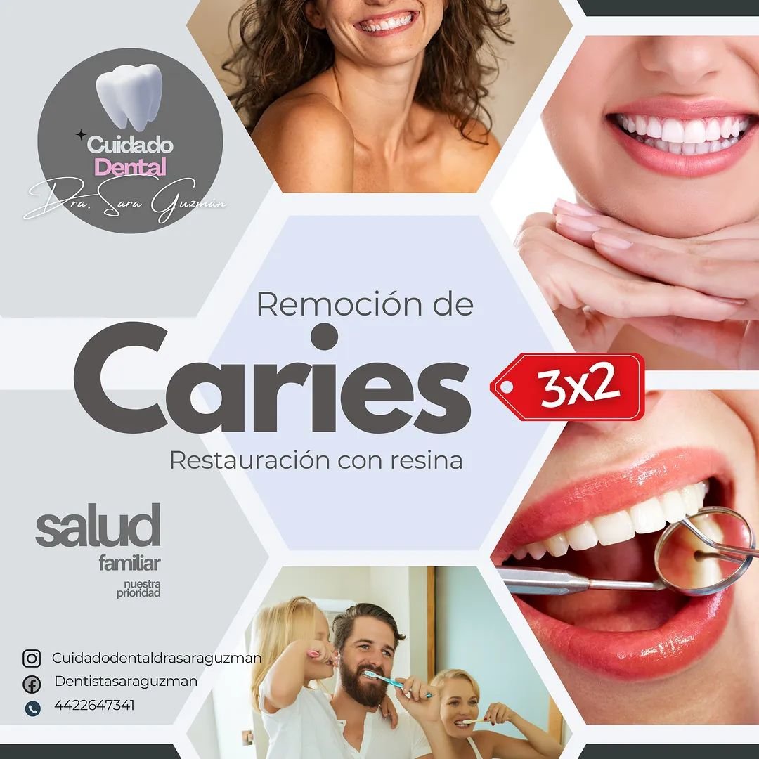 Anuncio de Cuidado Dental Dra. Sara Guzmán: remoción de caries