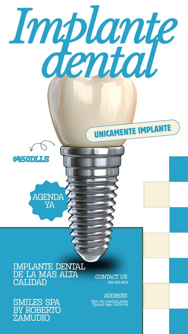 Anuncio de Dentista Roberto Zamudio: Implante dental