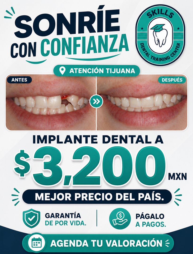 Anuncio de Skills Dental Training Center: Implante dental