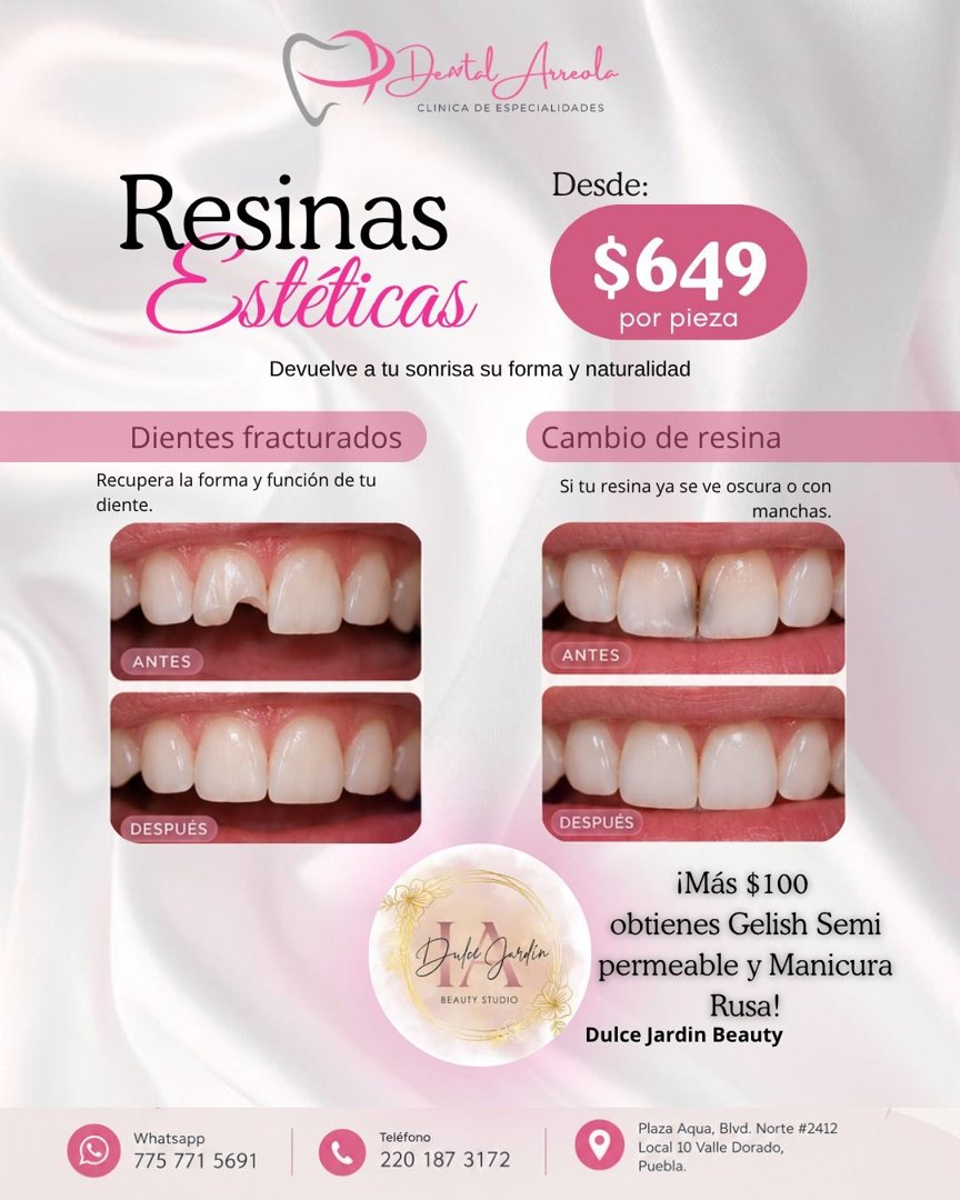 Anuncio de Dental Arreola: Resinas estéticas