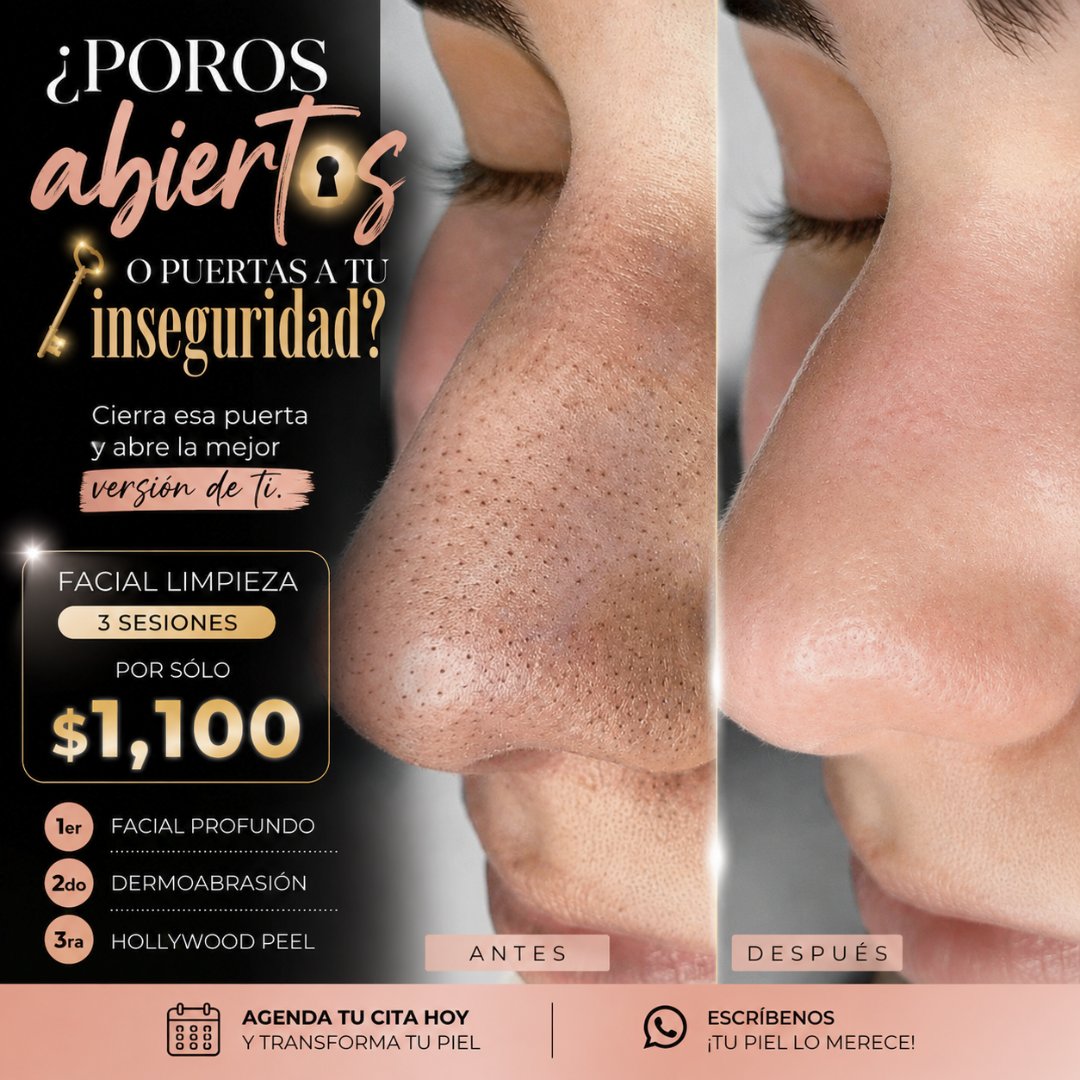 Anuncio de La casa del glamour: Facial limpieza