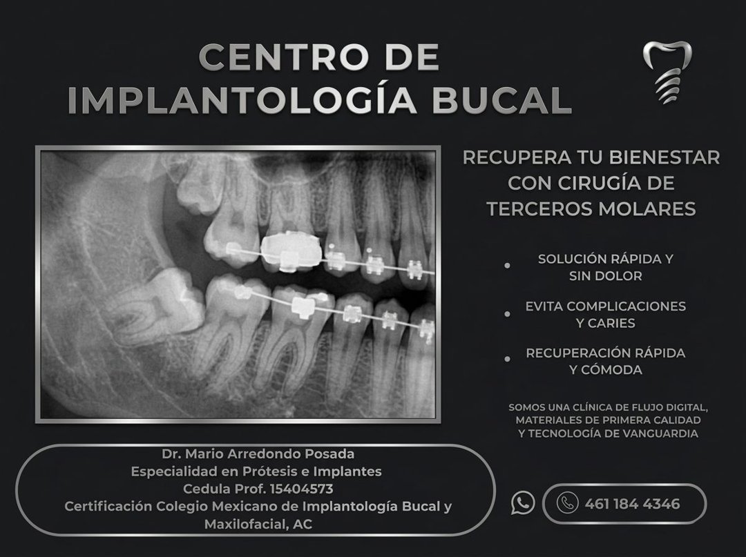 Anuncio de Centro de Implantología Bucal Arredondo: Implantes dentales y cirugía de terceros molares