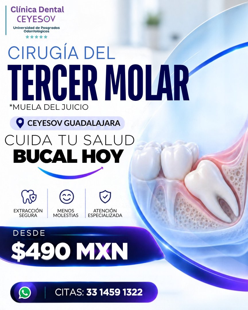 Anuncio de Clínica Dental Ceyesov: Cirugía del tercer molar