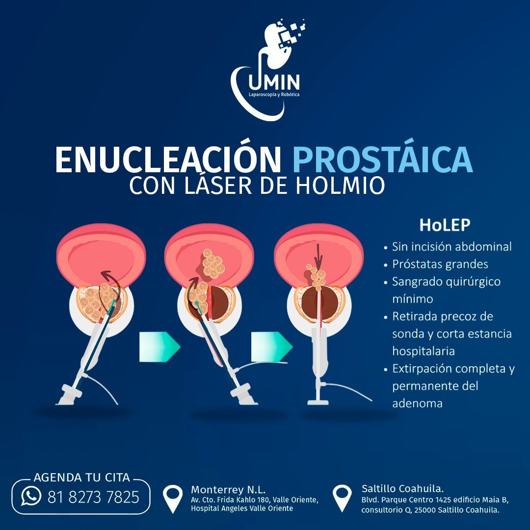 Anuncio de Urólogo en Monterrey Dr. Juan Ivan Briseño: Enucleación prostática con láser de Holmio