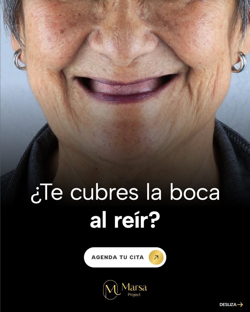 Anuncio de Marsa Project: rehabilitación oral e implantes