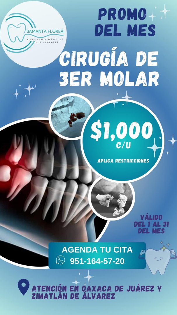 Anuncio de Clinica Dental “Florean”: cirugía de 3er molar