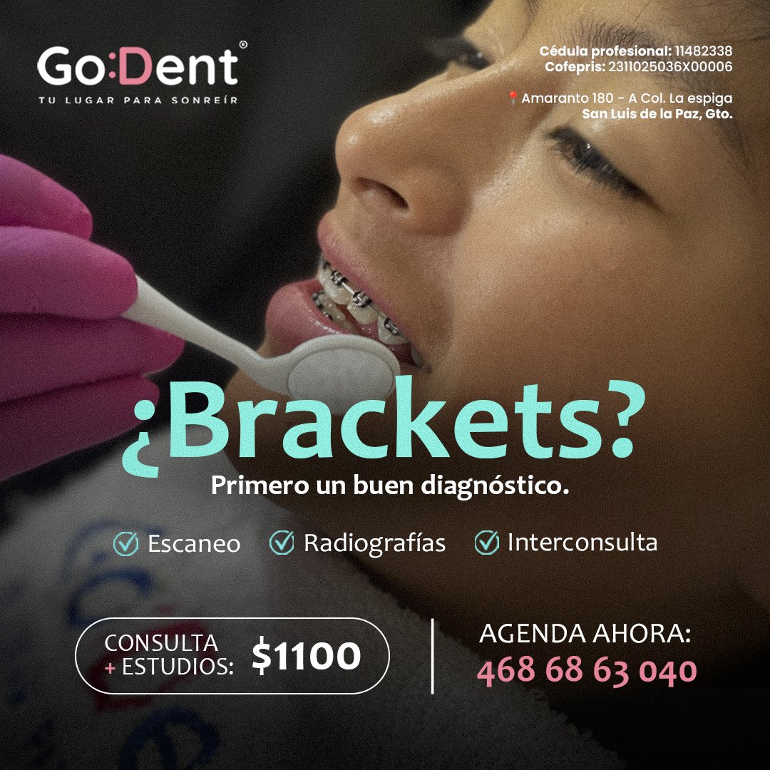 Anuncio de Clinica Go Dent: Consulta dental con estudios para brackets