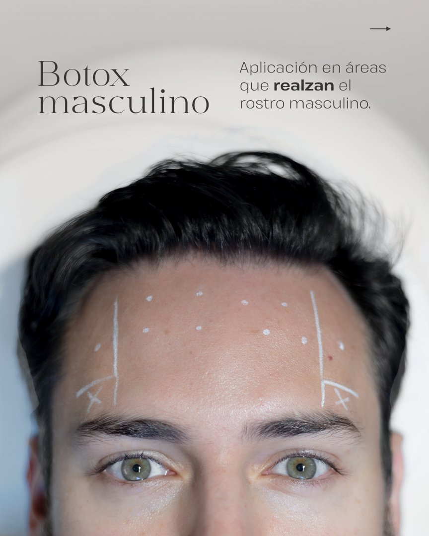 Anuncio de Harmony Clinic Boutique: Botox masculino