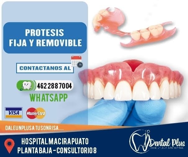 Anuncio de Dental Plus Irapuato: prótesis dental