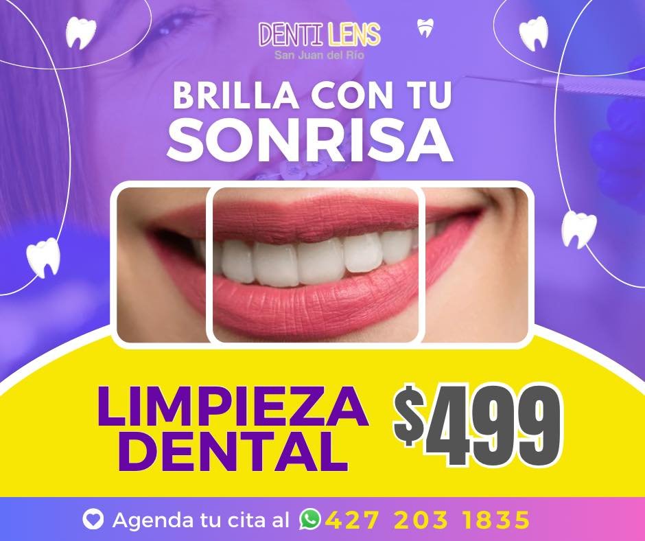 Anuncio de Dentilens San Juan del Río: Limpieza dental