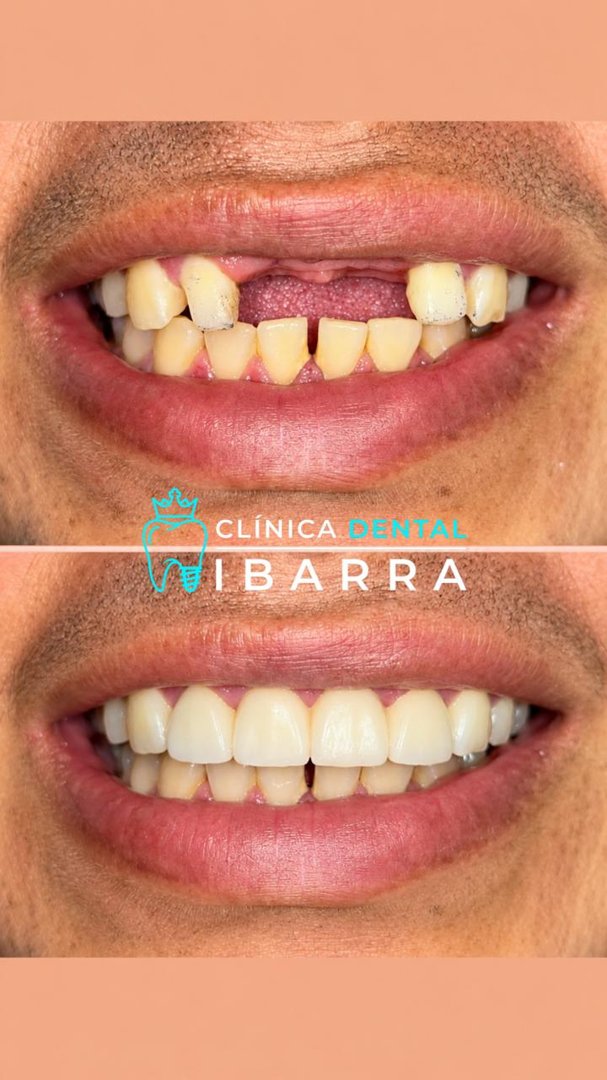 Anuncio de Clínica Dental Ibarra: odontología
