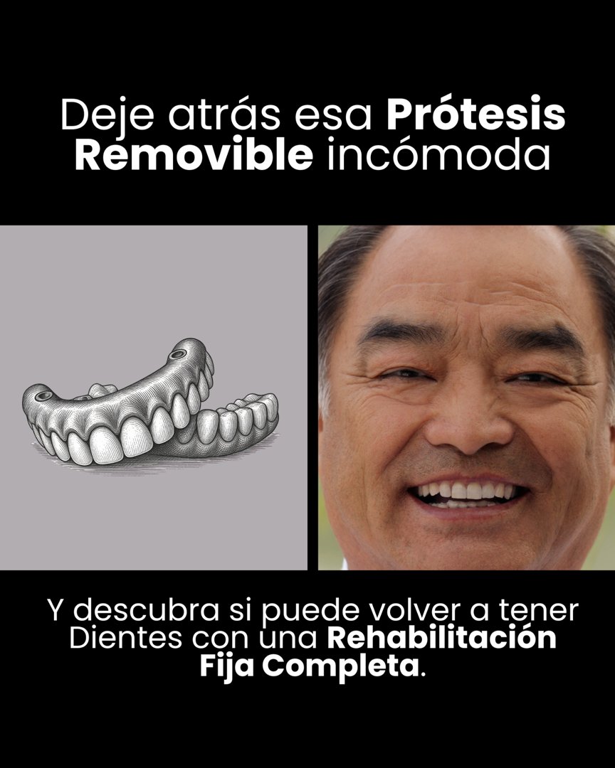 Anuncio de Calidad Dental: Rehabilitación dental fija