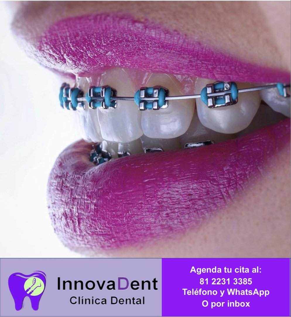 Anuncio de Innova Dent: tratamientos dentales