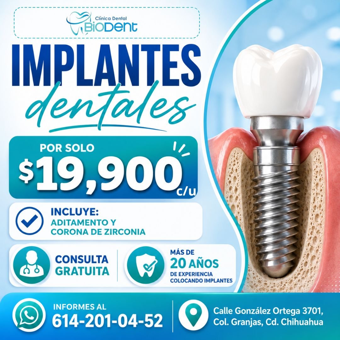 Anuncio de Biodent: Implantes dentales