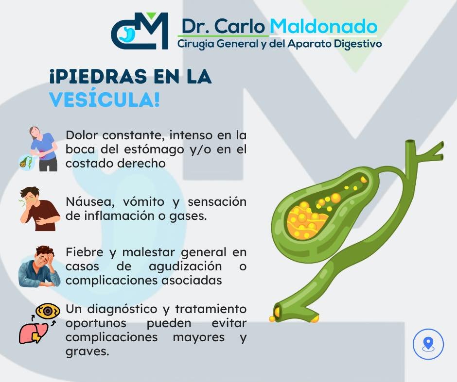 Anuncio de Dr. Carlo Maldonado - Cirugía General y del Aparato Digestivo: Colecistectomía Laparoscópica
